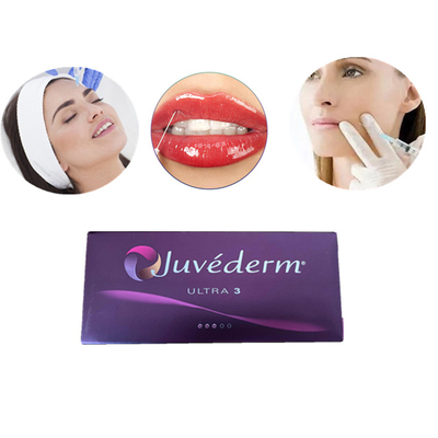 Juvedermは心配のHyaluronic酸の皮膚注入口注射可能な2x1mlに直面する