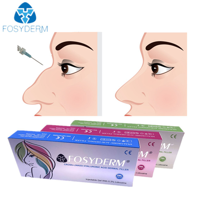 Hyaluronic酸の女性の使用のための皮膚鼻の注入口の注入1ml 2ml