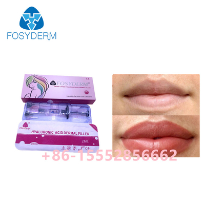 唇の強化のための2ml Fosydermの皮膚注入口のHyaluronic酸