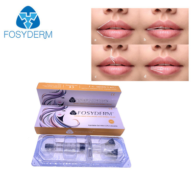 5ml唇のためのHyaluronic酸Fosydermの皮膚注入口の注入はゆっくり進む