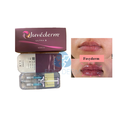 唇の強化のためのボリューム ヒアルロン酸皮膚フィラー Fosyderm