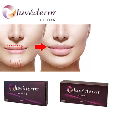 Juvederm Ultra3 ヒアルロン酸 唇用 皮膚用 注射用 ゲル 前記