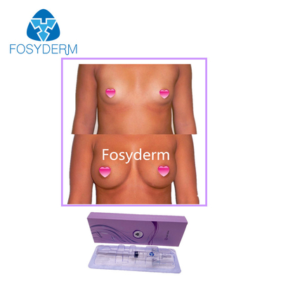 Fosyderm 10mlのHyaluronic酸の皮膚注入口バトックおよび胸の拡大の注入