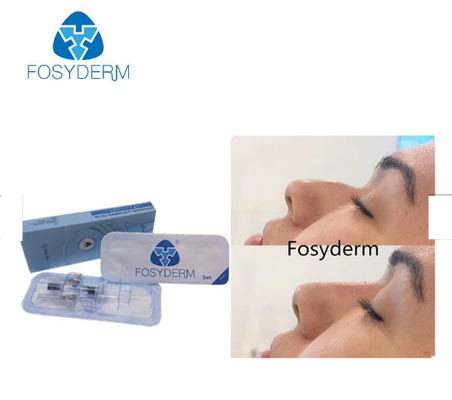 Fosydermの十字は鼻のための深いライン注入口2mlの皮膚注入口をつないだ