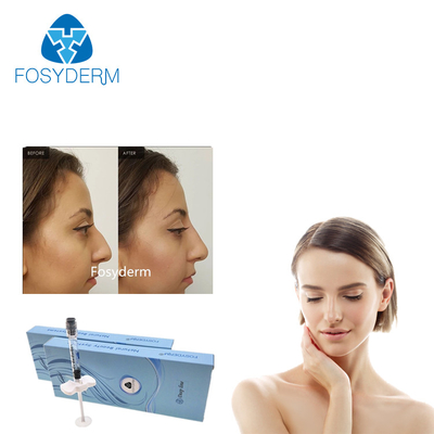 Fosydermの十字は鼻のための深いライン注入口2mlの皮膚注入口をつないだ