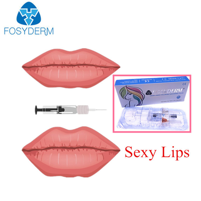 唇の十分のためのFosydermのHyaluronic酸の皮膚注入口2つのMlの深いライン