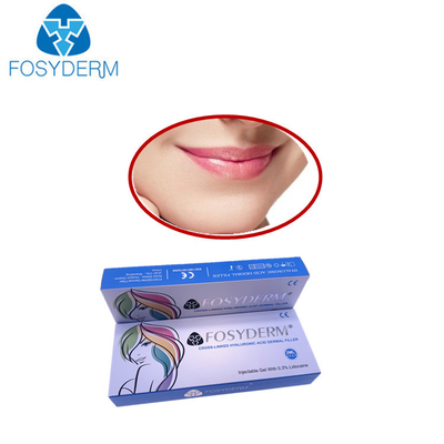 唇の十分のためのFosydermのHyaluronic酸の皮膚注入口2つのMlの深いライン
