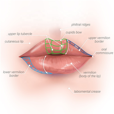 注射可能なHyaluronic酸の皮膚唇の注入口1ml/2ml