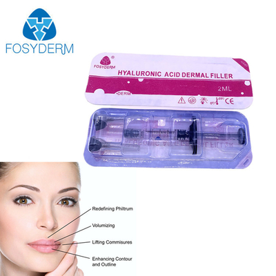 FosydermのHyaluronic酸の皮膚注入口の注入による2ml唇の十分