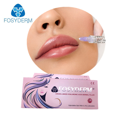 顔HAの皮膚注入口注射可能なFosyderm 2mlを持ち上げる唇の盛り土の頬