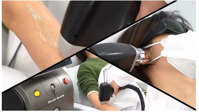 強力な新しい 808nm Ice Diodo Trio 3 Wave Diode Laser 810nm 脱毛 808 Nm 脱毛 3 波 チタン メディカル マチ 2