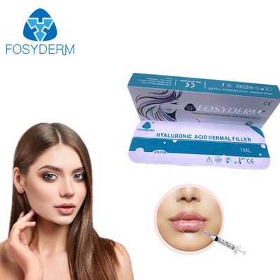 FosydermのセリウムのHyaluronic酸の十字は24mg/Mlの上の唇のための皮膚注入口をつないだ