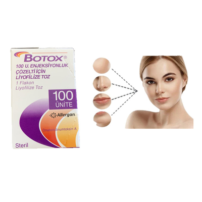 Allergan 100unitsのボツリヌス菌の毒素のの注入のしわの取り外し操作