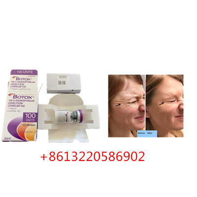 Allergan反老化するの注入100unitsは反しわをタイプする