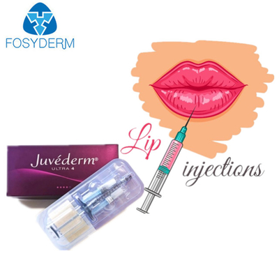 Juvedermの表面唇のための超3 Hyaluronic酸の皮膚注入口