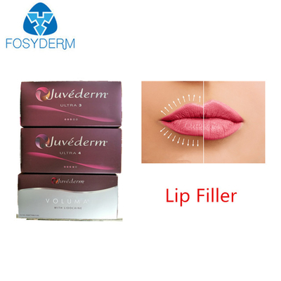Juvedermの表面唇のための超3 Hyaluronic酸の皮膚注入口