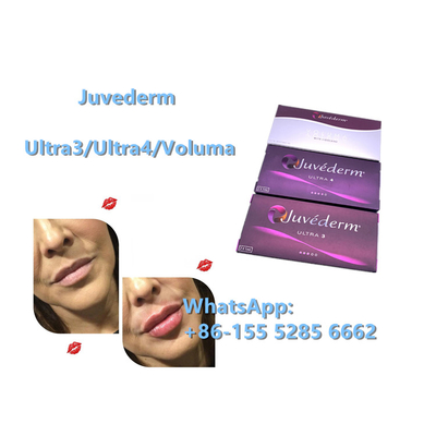 Juvederm Ultra4 24mg/Mlの皮膚注入口の反しわのHyaluronic酸の注入