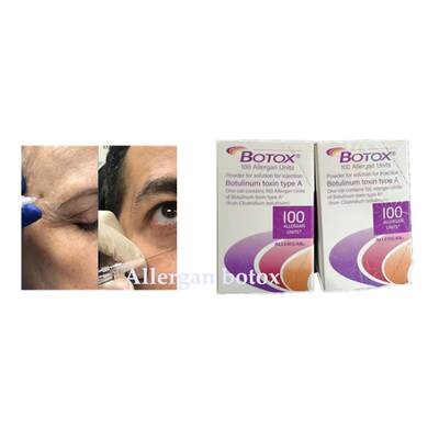しわのための毒素のAllerganボツリヌス菌のの注入は取除く