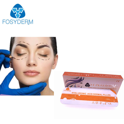 化粧品の注入のための長続きがする Fosyderm のヒアルロン酸の皮膚注入口