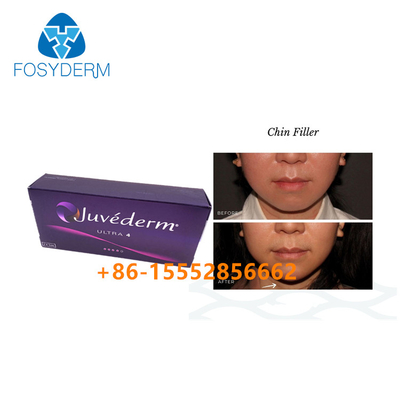 Chinの増加のHyaluronic酸の顔の注入口Juvederm Ultra4皮膚2ml