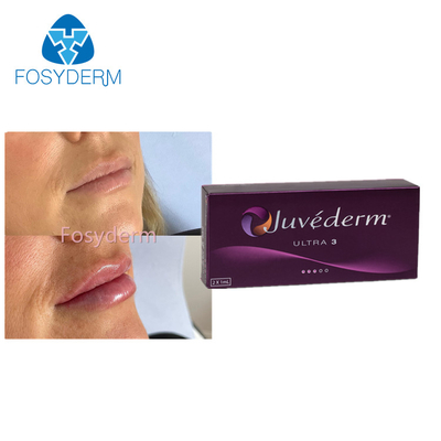 Juvederm Ultra3の唇の強化のHyaluronic酸の皮膚注入口2x1.0ml
