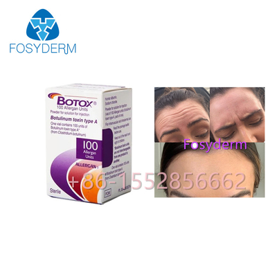 Allergan は100つの単位のボツリヌス菌の毒素の反しわ注入をタイプする