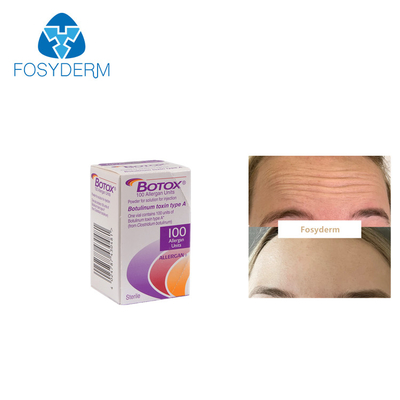Allergan は100つの単位のボツリヌス菌の毒素の反しわ注入をタイプする
