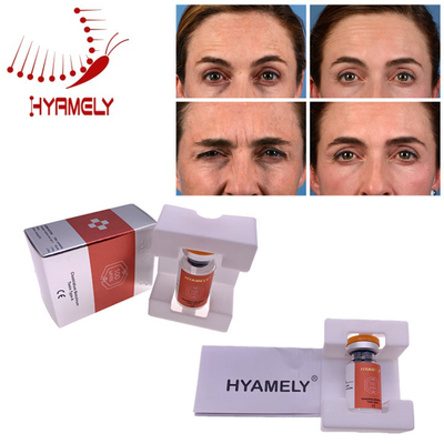 韓国の文書のHyamely の顔のしわのためのボツリヌス菌の毒素の注入
