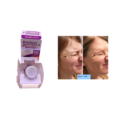 Allerganしわの取り外しの皮膚注入口の注入のための100単位