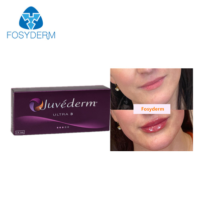 Juvederm 2*1mlの皮膚唇の注入口の反老化のための十字によってつながれるHyaluronic酸の注入