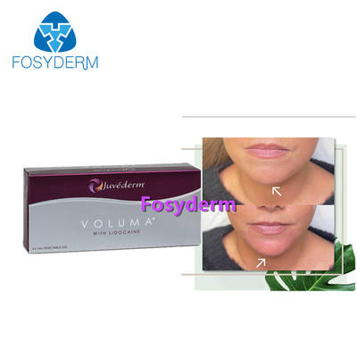 Juvederm 2*1mlの皮膚唇の注入口の反老化のための十字によってつながれるHyaluronic酸の注入