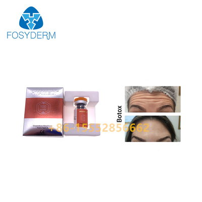 100units TypeAのボツリヌス菌の毒素の注入の反しわ Allergan