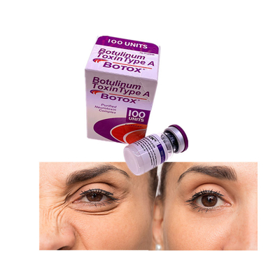 美顔術を取除くことはボツリヌス菌の毒素100の単位Allergan oを並べる