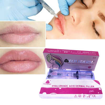 唇の充填剤 唇の満度拡大剤 2ml 皮膚の充填剤 Fosyderm HA 充填剤 注射