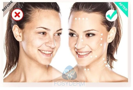 Anti wrinkle Filorga  135HA メソセラピー 血清 肌活性化剤