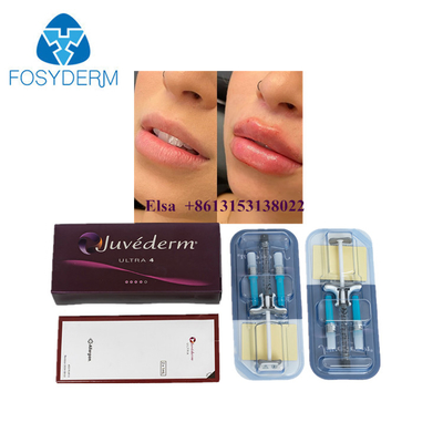 Juvederm インジェクタブル皮膚フィルラー Juvederm Ultra3 Ultra4 Voluma