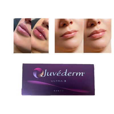 Juvederm ヒアルロン酸 皮膚填充剤 顔面の唇填充剤