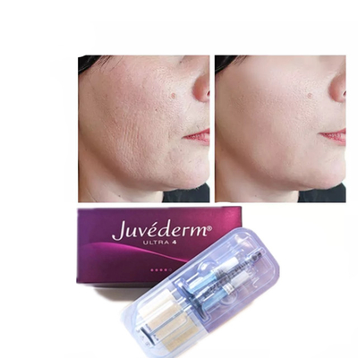 Juvederm ヒアルロン酸 皮膚充填剤 アンチエイジング 2*1ml 顔充填剤