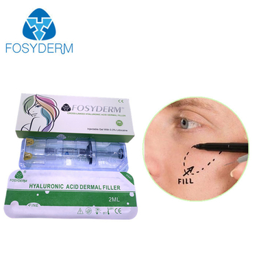 Fosyderm 深層 2ml 皮膚充填剤 顔の若返しのための HA 充填剤