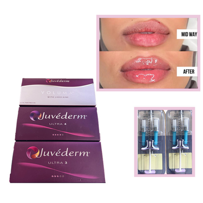 Juvederm Voluma Ultra3 Ultra4 HA ジェルフィラー 2ml ヒアルロン酸