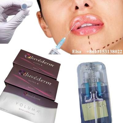 Juvederm Ultra4 Voluma Dermal Filler Anti Wrinkles ヒアルロン酸インジェクション 顔用