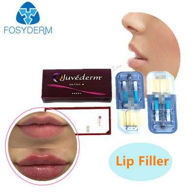 2ml ヒアルロン酸皮膚充填剤 JUVEDERM 注射用ゲル くるみ充填剤