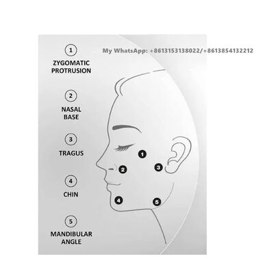 プロファイロ 64mg/2ml ヒアルロン酸ダーマルフィラー注射 スキンケア