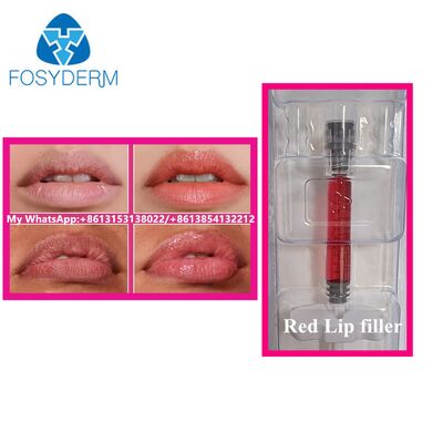 ビタミンB12を注入する赤の唇のフィルラー ヒアルロン酸のフィルラー 美容唇拡大剤 1ml