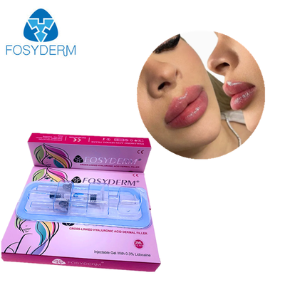 フォシダームフィラー ヒアルロン酸ダーマルフィラー リップ用注入剤 2ml