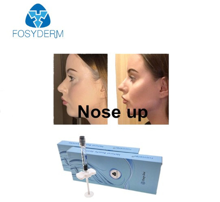 鼻のための表面のFosyderm 1mlの深いライン塩酸の注入