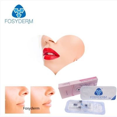 Fosyderm 2mlを交差させます唇の強化のためのつながれたHyaluronic酸の皮膚注入口をゼリー状になって下さい