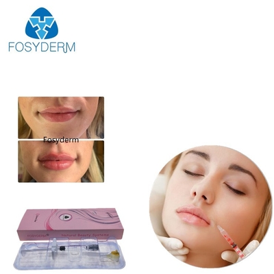 Fosyderm 2mlを交差させます唇の強化のためのつながれたHyaluronic酸の皮膚注入口をゼリー状になって下さい