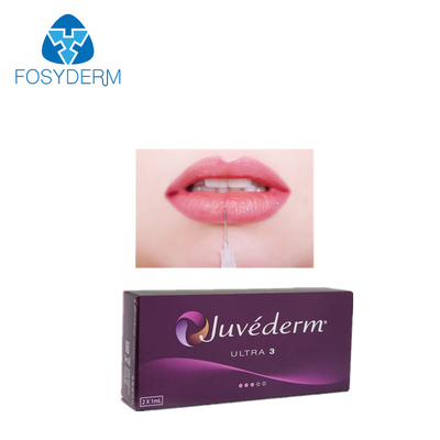 唇のJuvedermの超3 Hyaluronic酸の皮膚注入口2*1ml