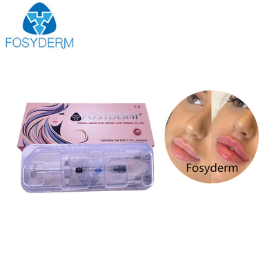 Fosyderm 100%の純粋な十字は唇の注入口のための1ml注入のHyaluronic酸をつないだ